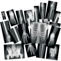 Set De 18 Laminas De Rayos X